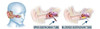 EarPopper EP2100 ENT Home Unit Ear Relief Device