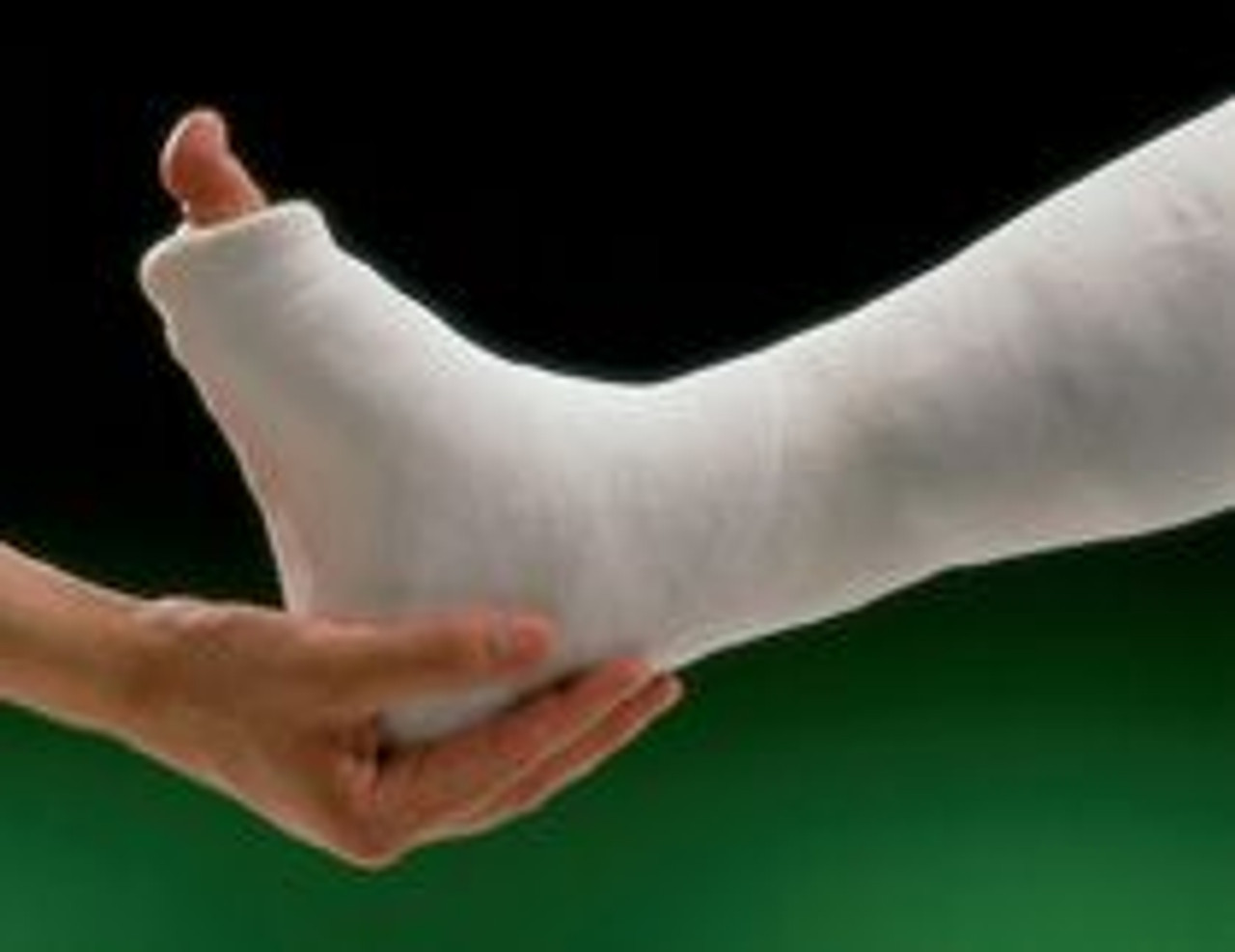 BSN-5753 GYPSONA ROLL PLASTER OF PARIS SPLINTING SYSTEM, 15 LAYERS, 15CM X 7.3M BX/1