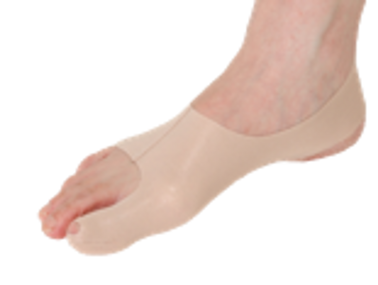 EA/1 INFRACARE BUNION ALIGNER KIT, LEFT, SMALL, BEIGE