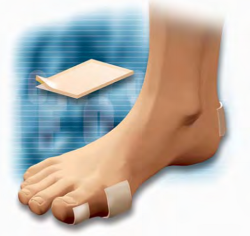 Calbenium Stick-On Padding 4/pk One Size (CC224) (OA-CC224)