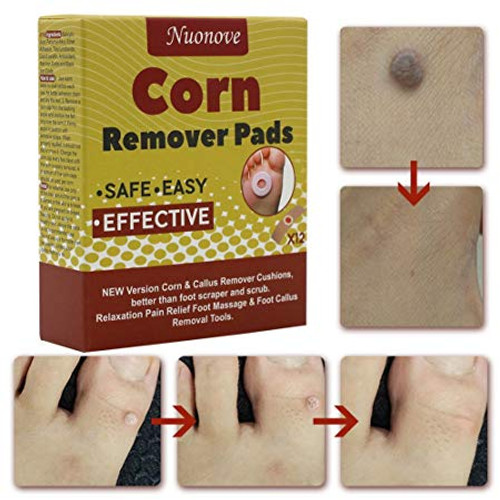 Calbenium Corn Bandages Self Adhesive One Size (CC235) (OA-CC235)