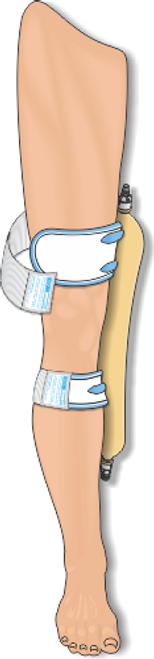 UROCARE 6347 FABRIC UPPER LEG BAG STRAPS, SIZE 9"-15" (Urocare 6347) UROCARE 6347 FABRIC UPPER LEG BAG STRAPS, SIZE 9"-15" (Urocare 6347)