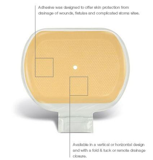 CONVATEC 839253 Pouch FISTULA FLD/TK 9.7X6.3" - 5/Box 839253 (CONVATEC 839253)