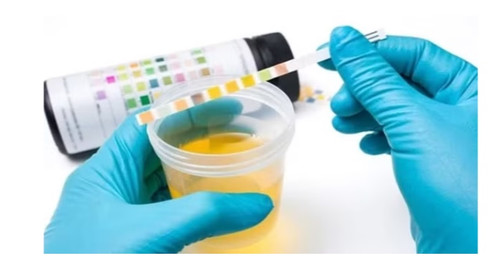 10 PARAMETER URINALYSIS STRIPS 5 Bottles (URS-10T)