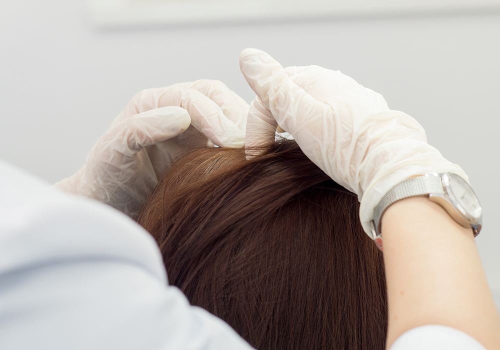 SERVICIO ANÁLISIS CAPILAR 1