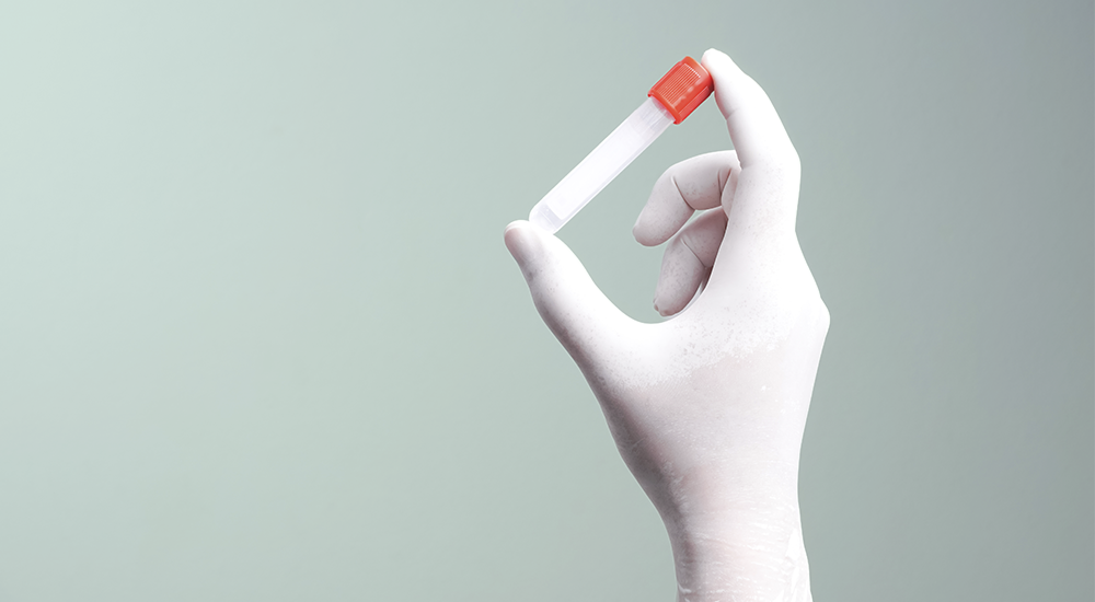 imagen servicio colesterol home