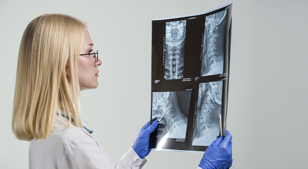 imagen servicio Densitometría ósea