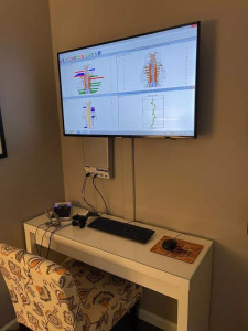 Insight by CLA Neurothermal Thermography sEMG HRV Free Laptop Free Software Insight by CLA Neurothermal Thermography sEMG HRV Free Laptop Free Software