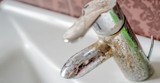 Understanding the Difference Between Hard Water and Acidic Water