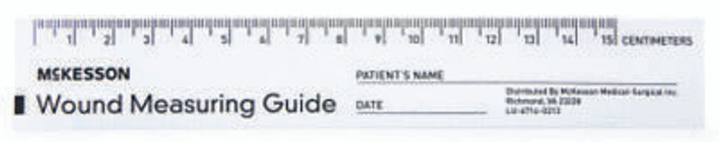 Wound_Measuring_Guide_6_Inch_Paper_NonSterile1