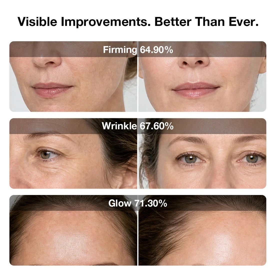 JOVS 6D before and after facial treatment results