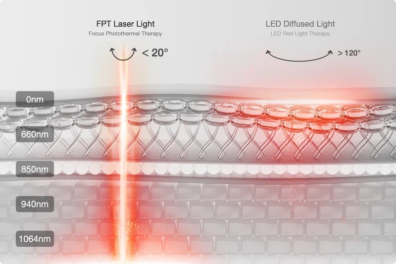 laser light therapy