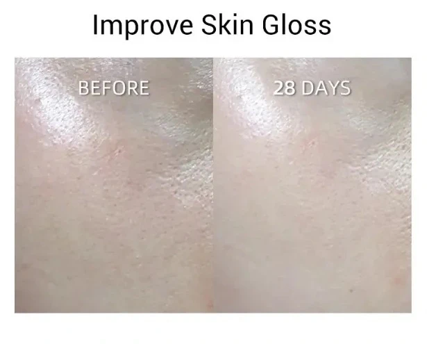 JOVS Light Therapy Panel before and after result