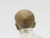 Turnbuckle Biter Bald Head