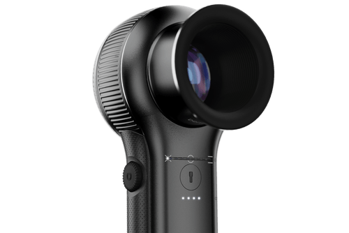 DermLite DL5 Hybrid Dermascope DermLite DL5 Hybrid Dermascope