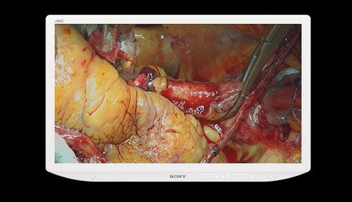 Sony Medical LMD-X3200MD 32-inch 4K 2D LCD Medical Monitor