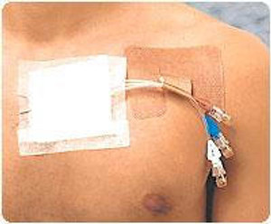 Derma Science Cath Strip Reclosable  Catheter Fastener  Derma Science Cath Strip Reclosable  Catheter Fastener