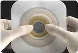 Convatec Natura Moldable Durahesive, Flange 2 3/4In (70Mm), Cut-To-Fit 1-5/16In (33Mm) - 1 3/4In (45Mm)  Convatec Natura Moldable Durahesive, Flange 2 3/4In (70Mm), Cut-To-Fit 1-5/16In (33Mm) - 1 3/4In (45Mm)