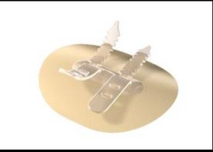 Bioderm Low Profile Cathgrip Double Strap, Medium, Sterile Bioderm Low Profile Cathgrip Double Strap, Medium, Sterile