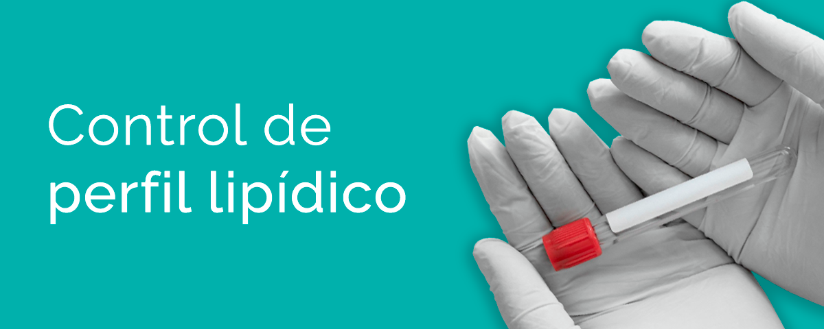 Nutrición deportiva en Farmacia Carmen Ortiz en Benacazón (Sevilla)