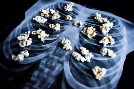 Can Vaping Cause Popcorn Lung?