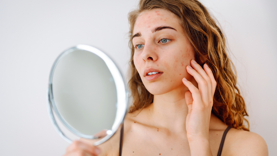 How Do I Know If I Have Sensitive Skin?