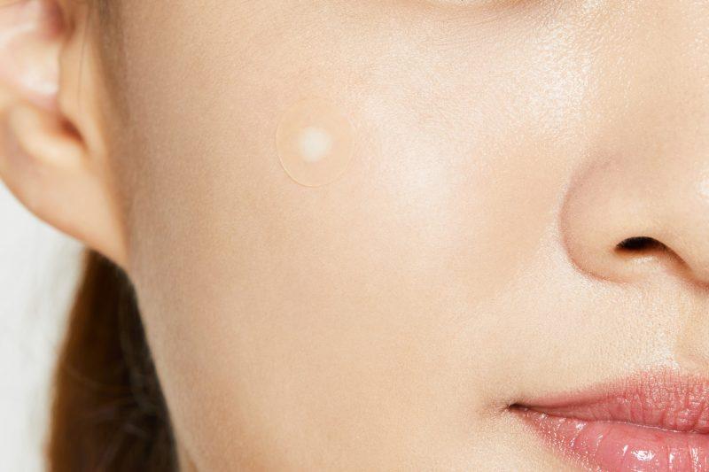 Which Pimple Patch is for You?