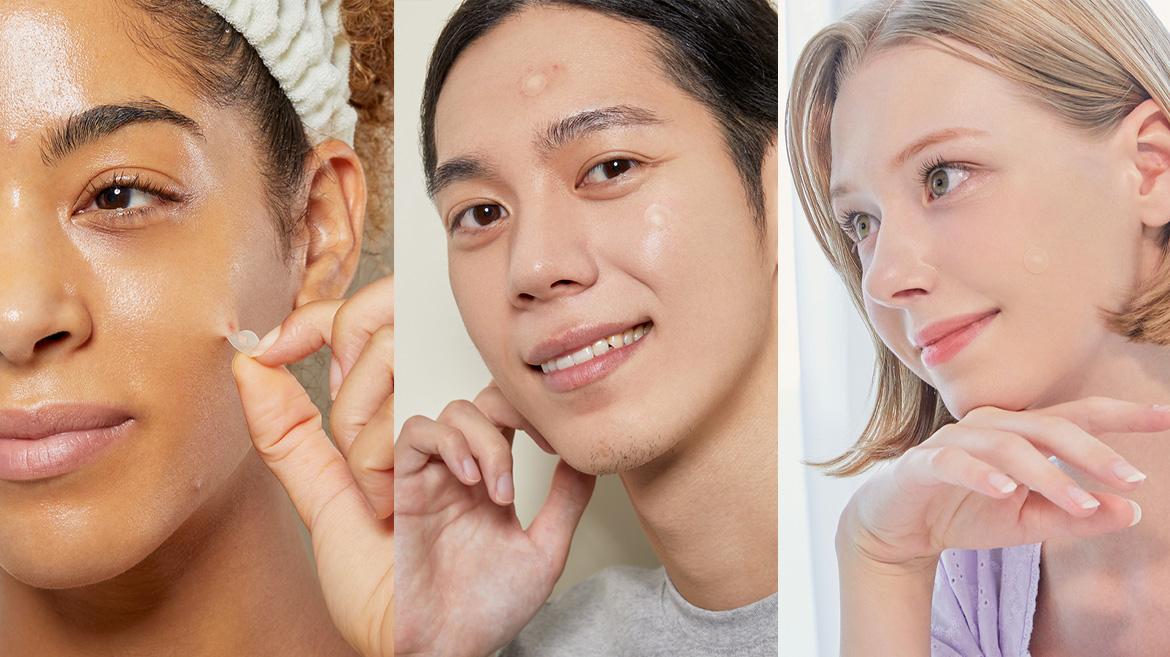 Do Pimple Patches Actually Work?