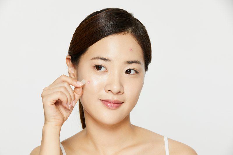 How to Treat Pityrosporum Folliculitis / Fungal Acne