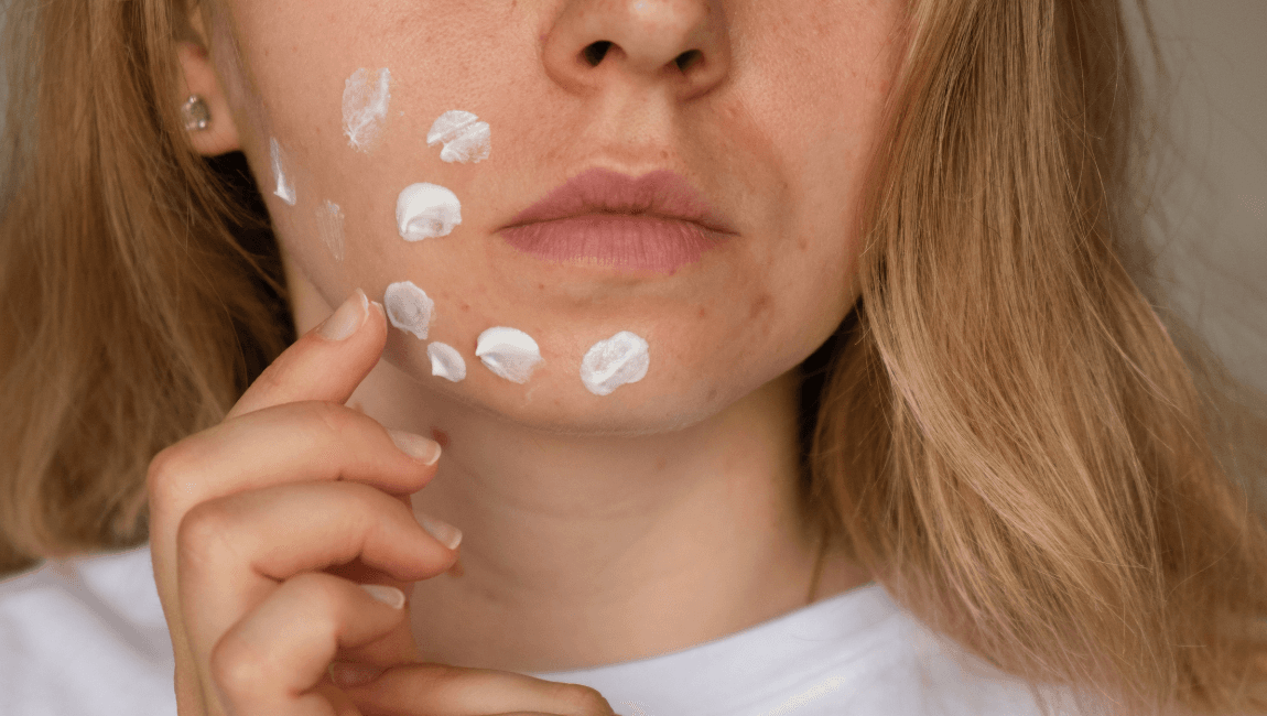 K-Beauty Must-Have Serums for Irritated and Acne-Prone Skin