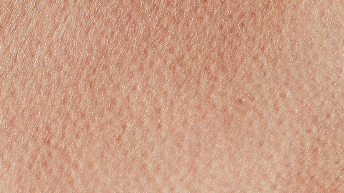 Our Take on Healthy Skin Month