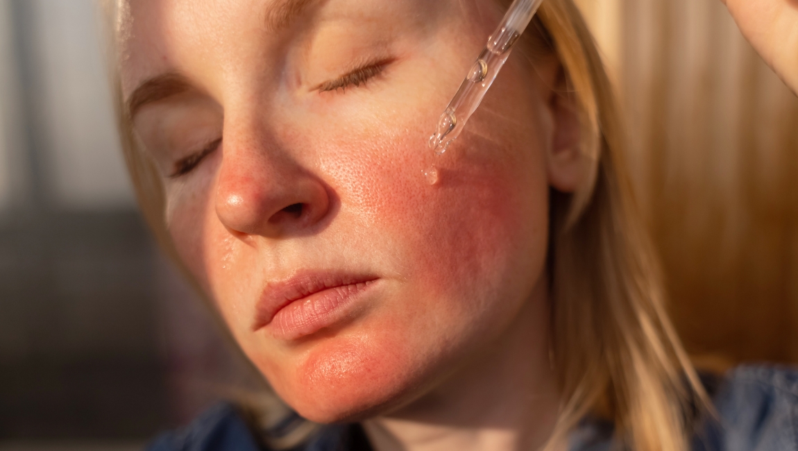 Top 5 Products for Redness Relief: Korean Skincare for Sensitive & Reactive Skin