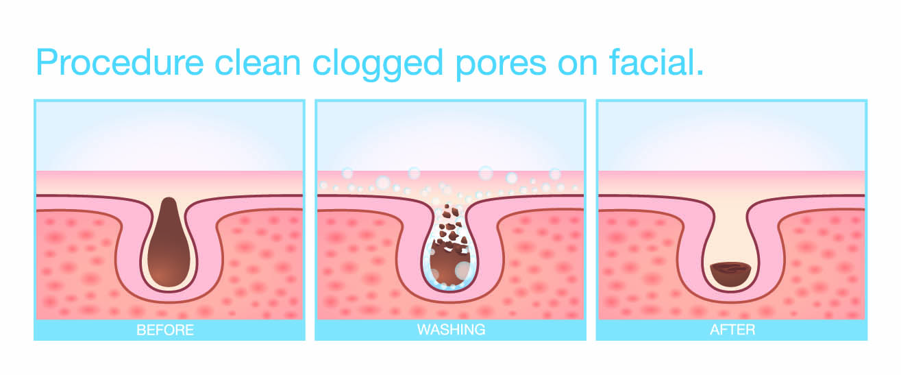 Korean skincare unclogged pores