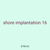 shore implantation 16