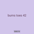 burns toes 42