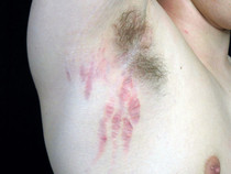 DermaSof Skin Repair Serum - 30ml Pump Bottle