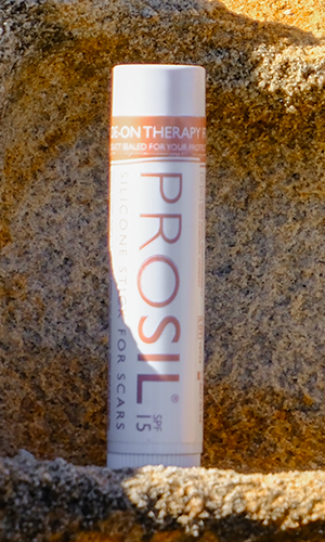 Face, Hands, Feet, Elbows