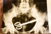 Surgical Hemostat Left in Woman 12 Years Cleveland X-Ray 6⅜x9 1947 AP Wire Photo V39