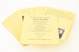 Stereoscopic Studies of Edinburgh Internal Face Section 9 No Case 39 Cards V21