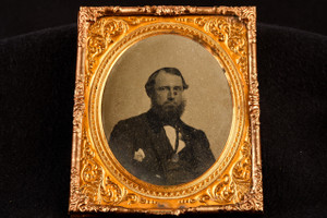 Ambrotype Photo Victorian Gentleman with Large Mole 1/6 Plate NO CASE V28