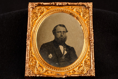 Ambrotype Photo Victorian Gentleman with Large Mole 1/6 Plate NO CASE V28