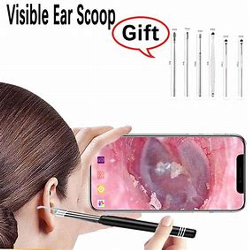 1 of 2099
Smart Visual Ear Cleaner Ear Stick Endoscope Earpick Camera Otoscope Ear Cleaner Ear Wax Remover Ear Picker Earwax