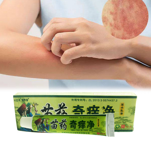 Treatment of Psoriasis Dermatitis Eczema Urticaria Beriberi Eczma Cream Chinese Herbal Plaster Skin Care