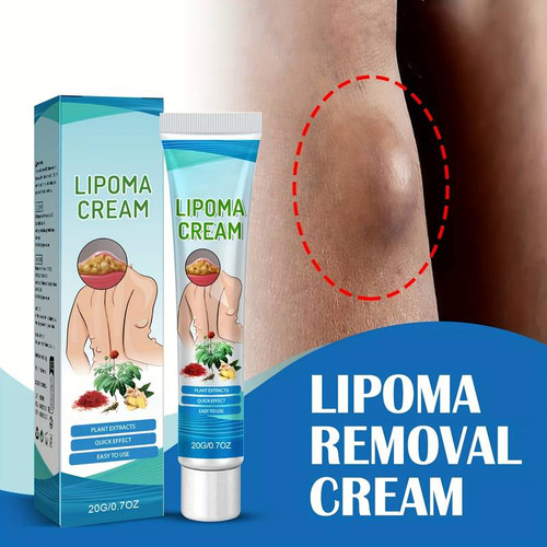 Lipoma Cream, Contains Ginger And Castor Oil, Body Care Cream For Moisturizing And Nourishing Skin Lip Balm Bulk Moisturizer Face Cream