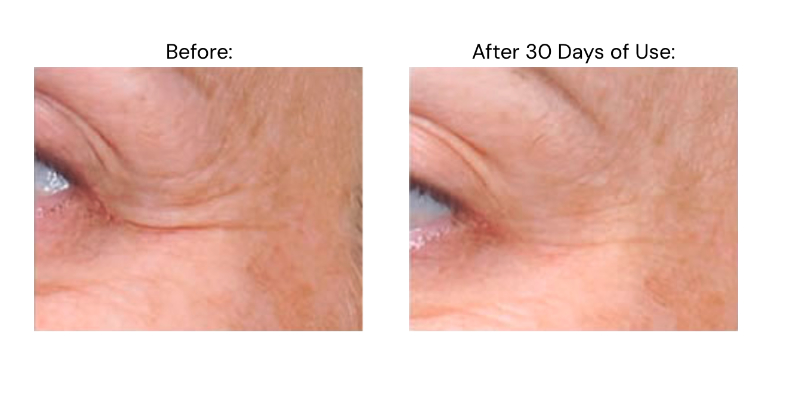 Eye Contour Revitalizing Serum Before & After