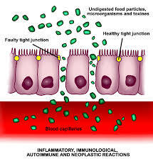 img-the-leaky-gut-syndrome.jpeg