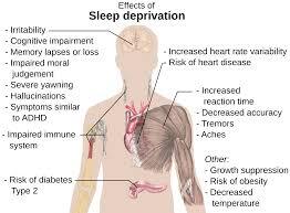 pathophysiology-of-sleep-debt.jpeg