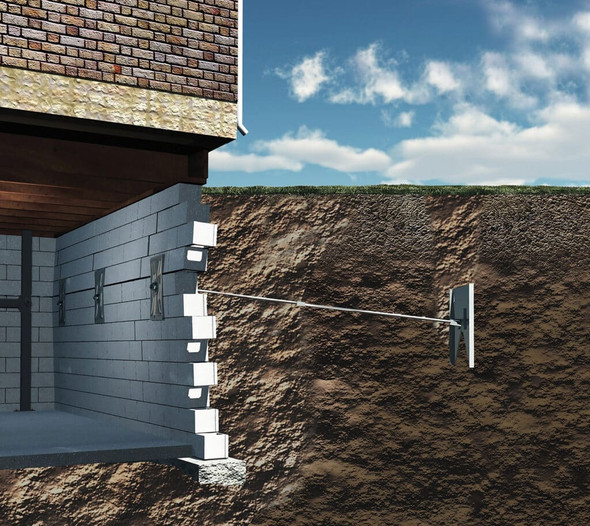 Dynamic Wall Anchor Kit