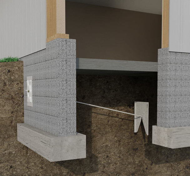 Dynamic Wall Anchor Kit