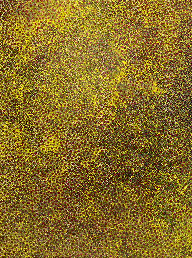 Ally Kemarre - MB027873